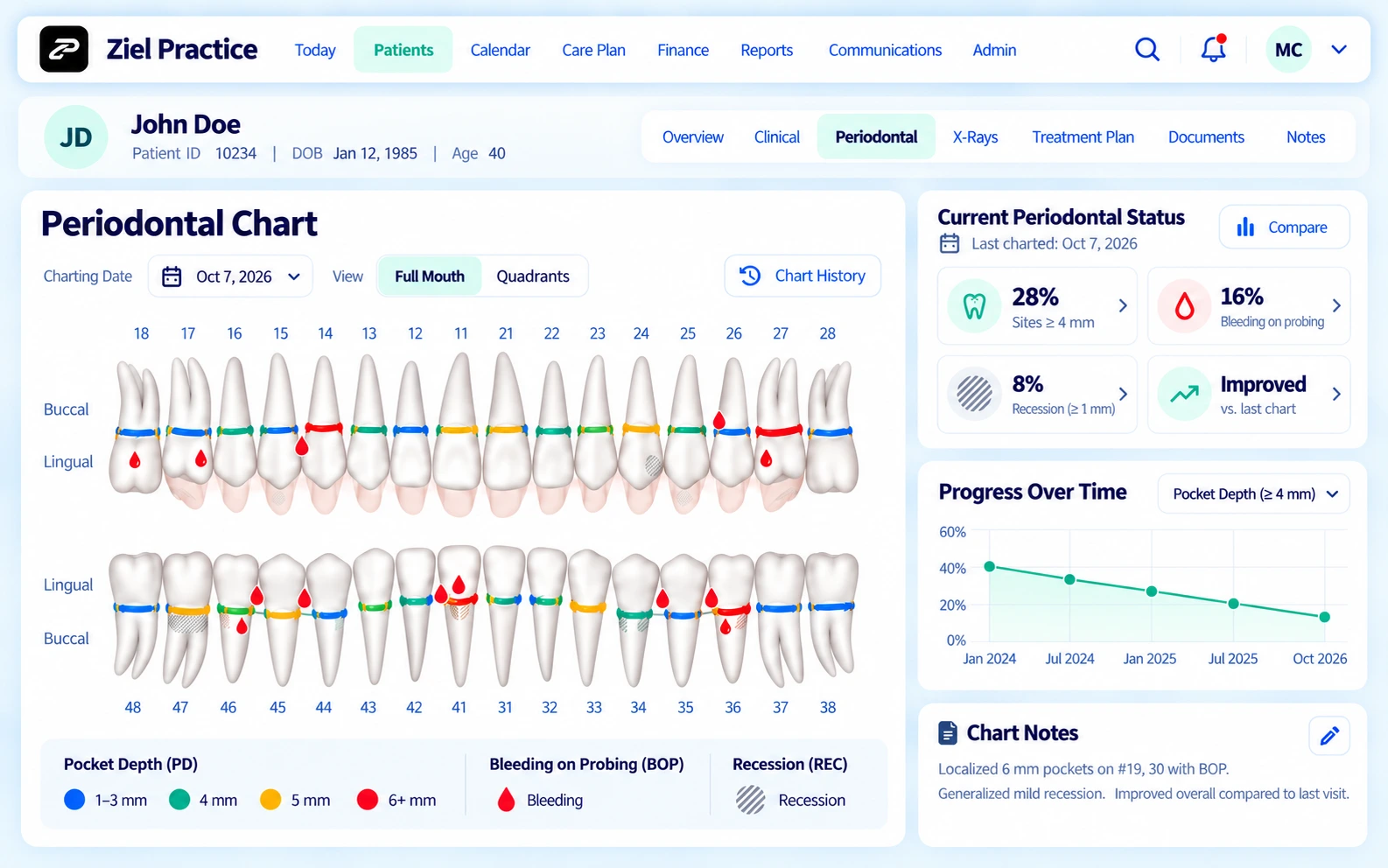 Ziel Practice Periodontal charting product view